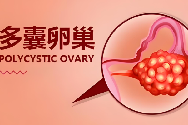 多囊两次试管成功案例分享，这些好孕经验值得借鉴