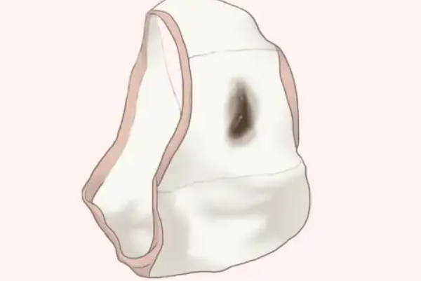 胚胎着床时会有出血的表现