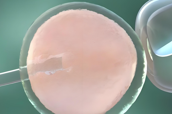 染色体异常囊胚送检不过