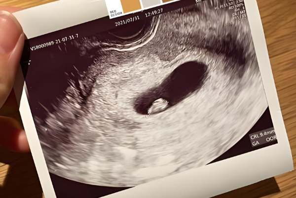 胚胎发育慢胎心出现时间晚