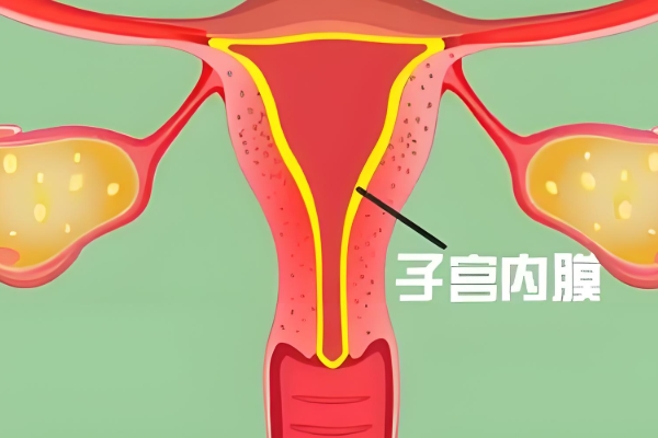 试管移植前要做好内膜调理