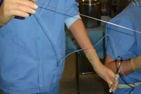 卵泡成熟后可安排取卵