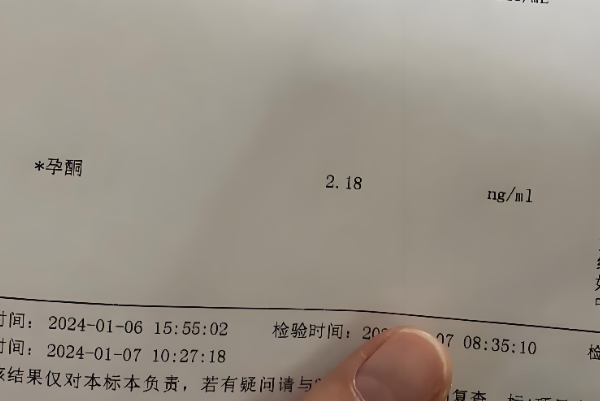 孕酮太高太低都不利于着床