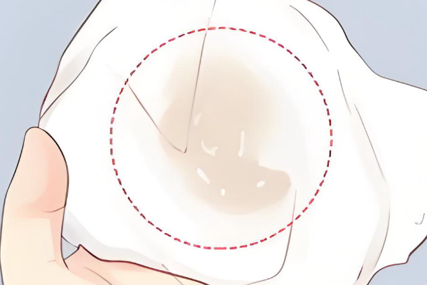 白带多表示激素水平正常