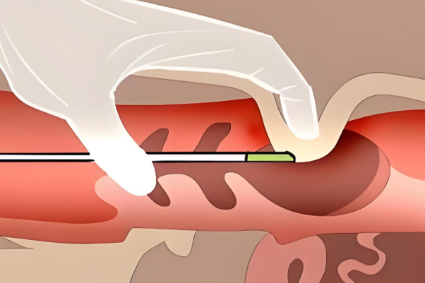 人授和试管的受孕方式不一样