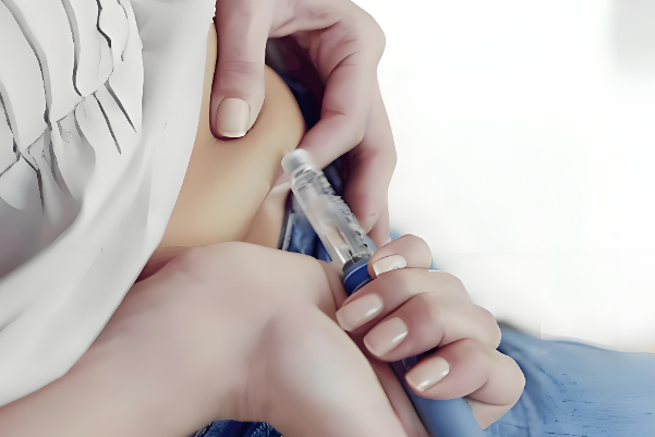 排卵针注射位置在脂肪厚的部位