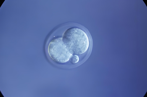 胚胎移植后心态要放松