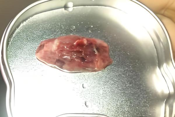 提前调理身体可提升胚胎质量